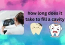 how long does it take to fill a cavity by postdock