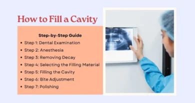 How to Fill a Cavity
